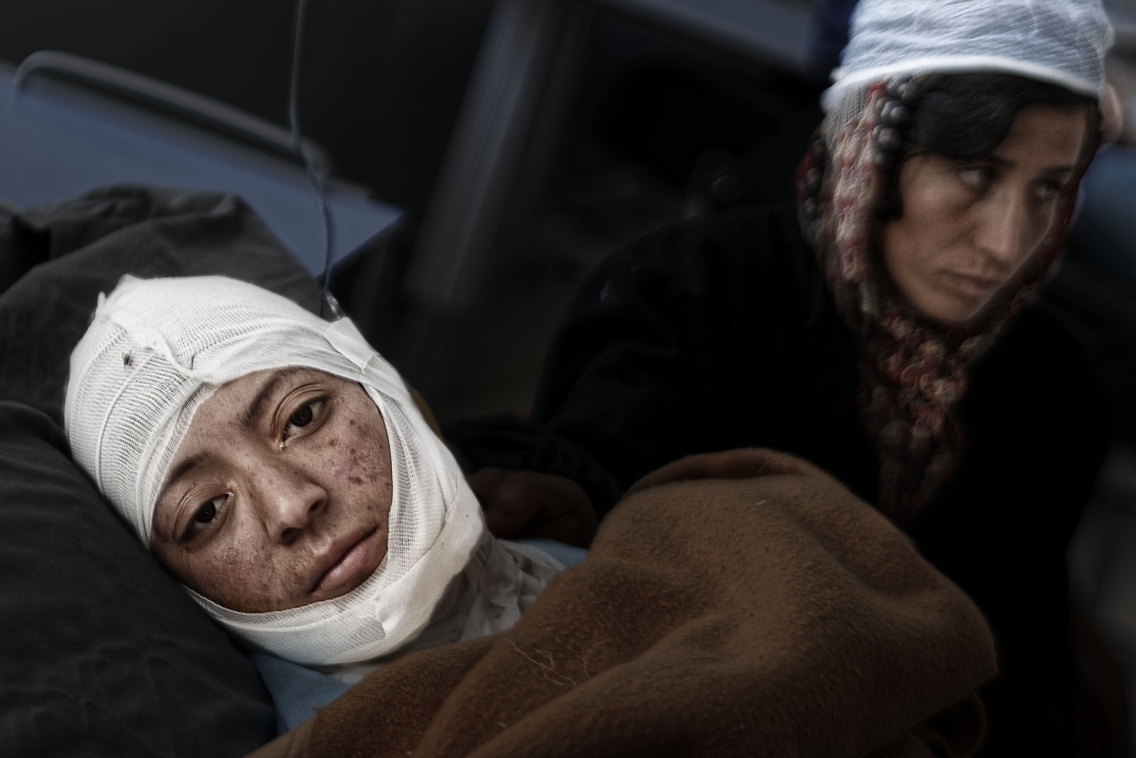 Afghanistan, ospedale Burning Centre di Herat dove vengono accolte le donne e i bambini ustionati. 
The woman tragedy of self-immolation in Afghanistan